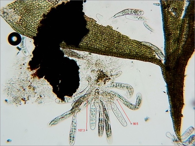 Bryostroma trichostoma (2) asci (x100) 2023_0210