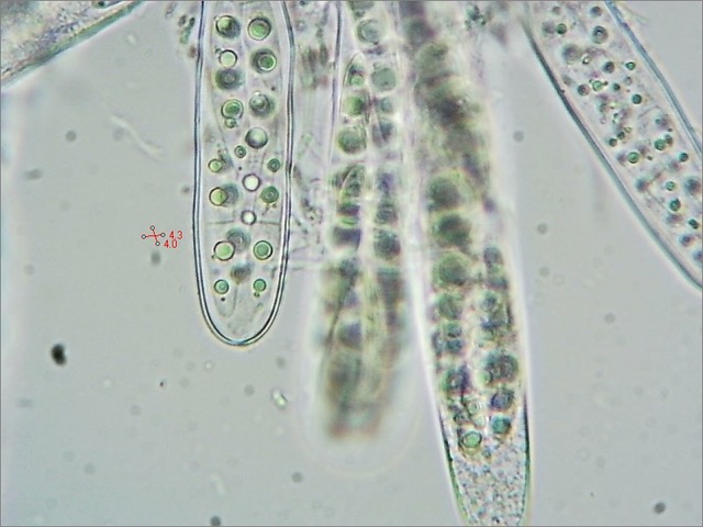 Bryostroma trichostoma (3) asci&#38;spores (x400) 2023_0210