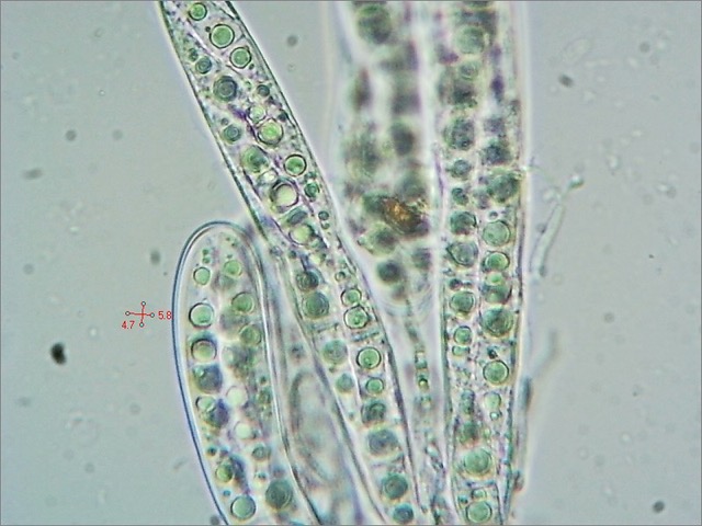 Bryostroma trichostoma (4) asci&#38;spores (x400) 2023_0210